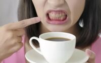 Apakah Kopi Merusak Gigi